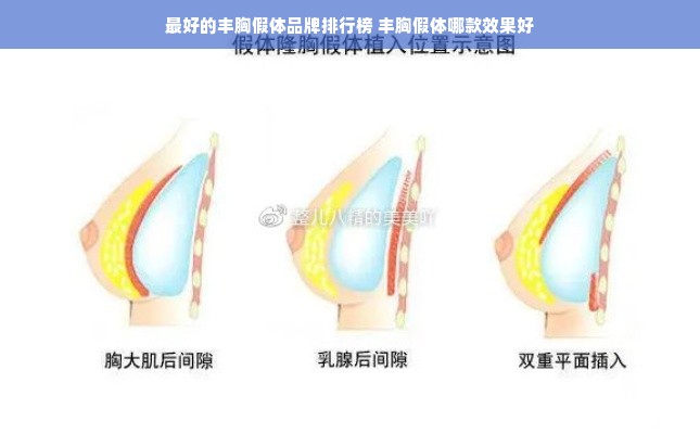 最好的丰胸假体品牌排行榜 丰胸假体哪款效果好