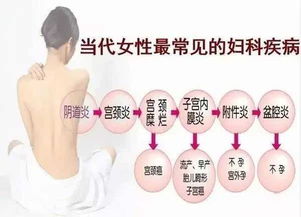 女性私护品牌排行榜，哪些牌子好？——为你打造健康美丽的生活