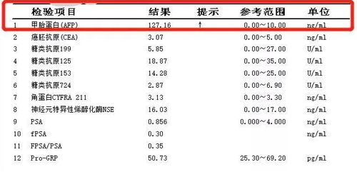 护肝品牌前十名排行榜有哪些？——为您的肝脏健康保驾护航