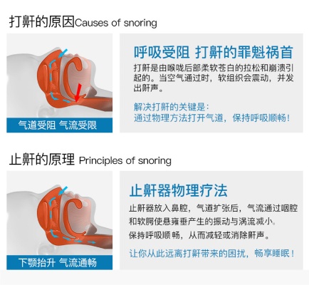 止鼾呼吸机品牌排行榜 止鼾呼吸机的工作原理