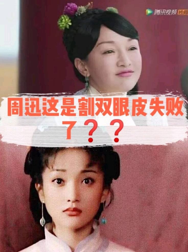 为什么会变双眼皮 为什么会变双眼皮的原因