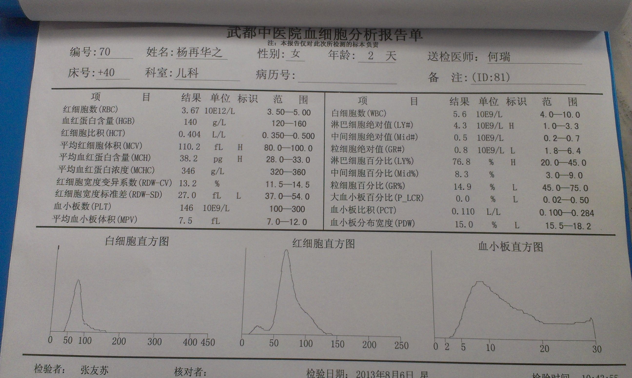 婴儿间接胆红素偏高的原因 婴儿间接性胆红素偏高是什么意思