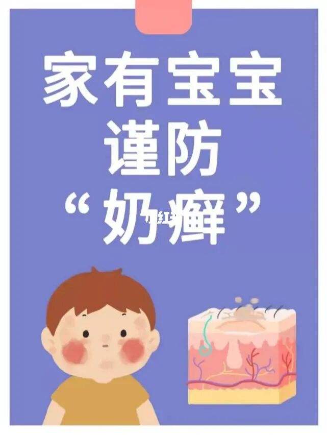 婴儿怎么预防湿疹 婴儿怎么预防湿疹复发